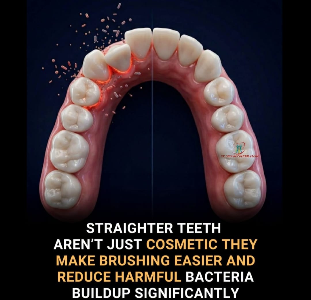 Teeth Alignment and Oral Health